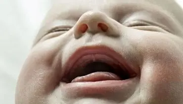 چرا لثه نوزاد دچار التهاب می شود ؟
