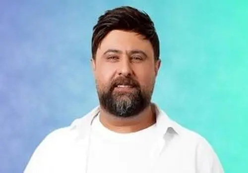 ویدیو زیرخاکی از محمد علیزاده قبل از شهرت و کاشت مو