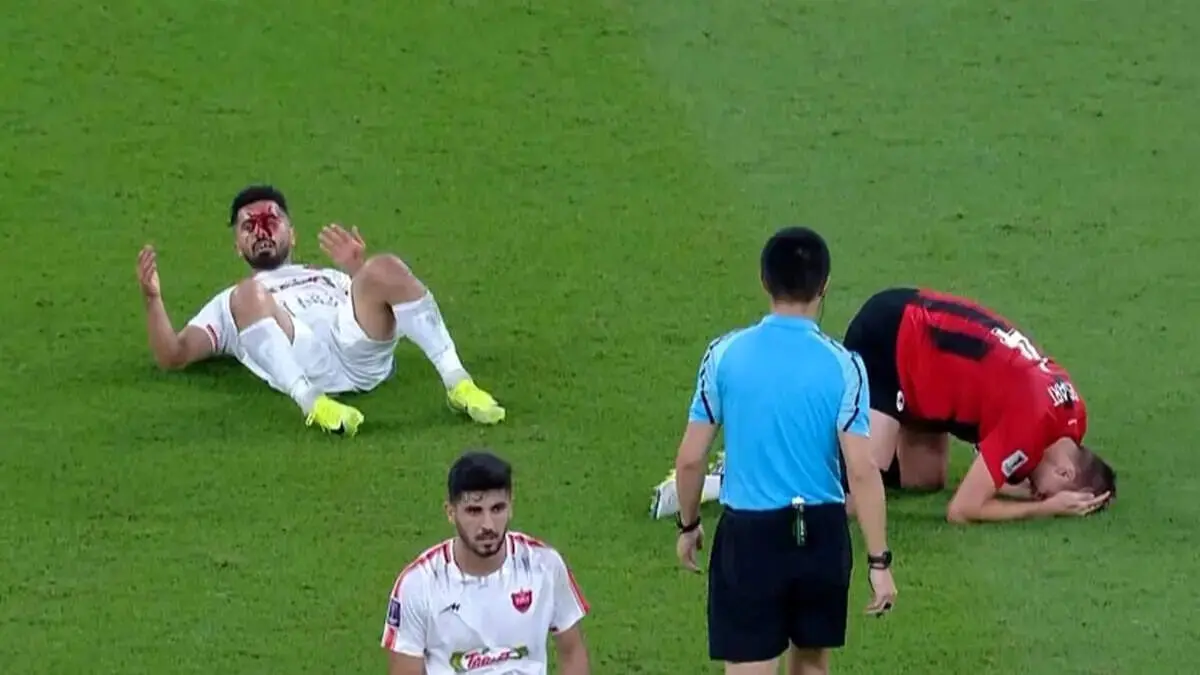 زمان بازگشت عالیشاه به میادین فوتبال از زبان پزشک پرسپولیس
