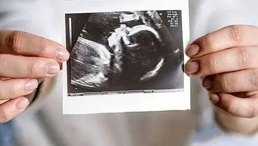 حمایت روانی موثرترین عامل برای حفظ بارداری بدون مشکل
