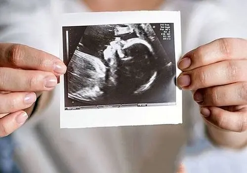 حمایت روانی موثرترین عامل برای حفظ بارداری بدون مشکل
