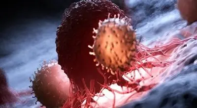 
غربالگری ۳ سرطان شایع در ایران