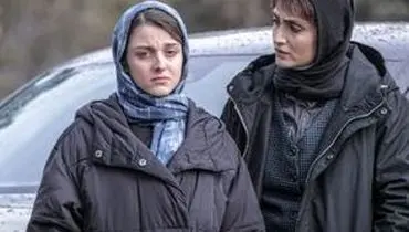 استایل تماشاییِ بازیگر خوش‌چهره زخم کاری