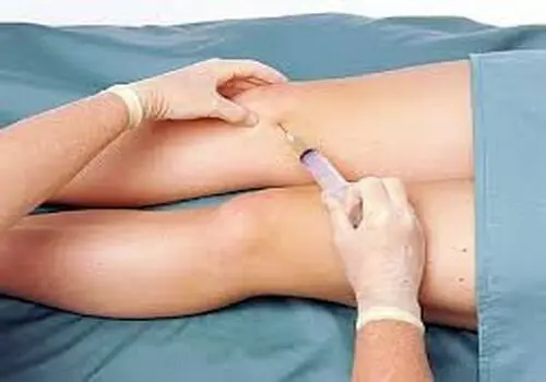 علت اصلی سوزش و گزگز زانو چیست؟