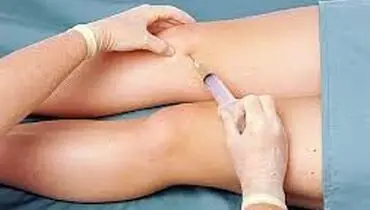 درمان خانگی آب آوردن زانو