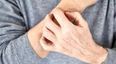 خطاهای رایج پوستی در هوای سرد 