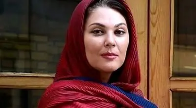 تغییر چهره لاله اسکندری بعد از عمل زیبایی/ ویدئو