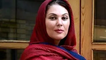 تغییر چهره لاله اسکندری بعد از عمل زیبایی/ ویدئو