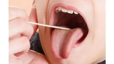 از روی زبان کمبود ویتامین دی را تشخیص دهید!
