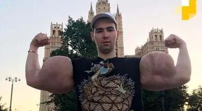 «ملوان زبل روسی» در آستانه قطع هر دو دست به دلیل عفونت ناشی از تزریق داروی بدنسازی