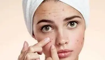 آیا بعد از استفاده از ضد آفتاب صورت جوش می زند؟
