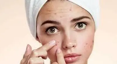 آیا بعد از استفاده از ضد آفتاب صورت جوش می زند؟
