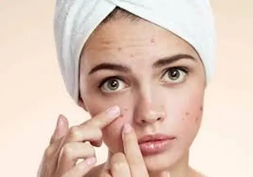 علت تغییر رنگ جرم گوش چیست؟
