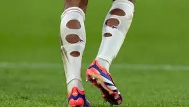 دلایل علمی پاره بودن جوراب ورزشکاران از پشت
