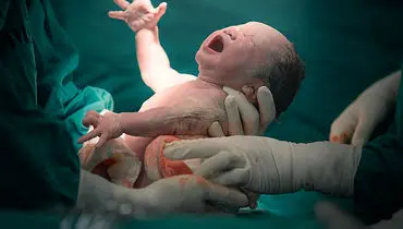 مادر شدن و کاهش ریسک سرطان در زنان + ارتباطی علمی
