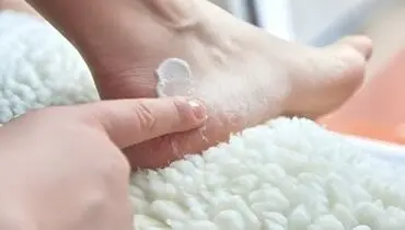 چرا پاشنه پا ترک می خورد؟