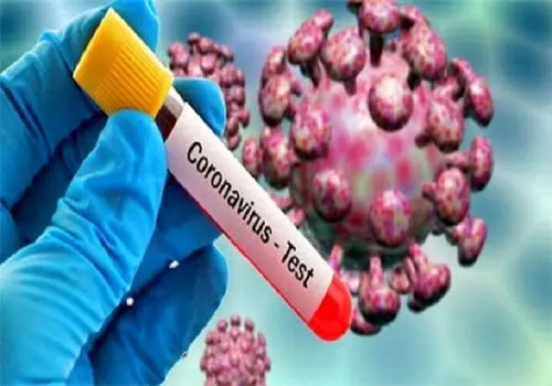 شناسایی موارد ابتلا به کرونا در میان زائران بازگشتی از اربعین در یزد