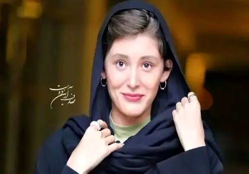 فرشته حسینی با "صورت زخمی" ظاهر شد!