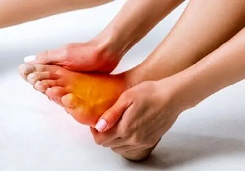 داغ شدن کف پا یعنی به این بیماریها مبتلا هستید