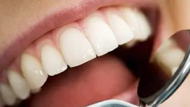 
افزایش شیوع سرطان دهان با استعمال دخانیات