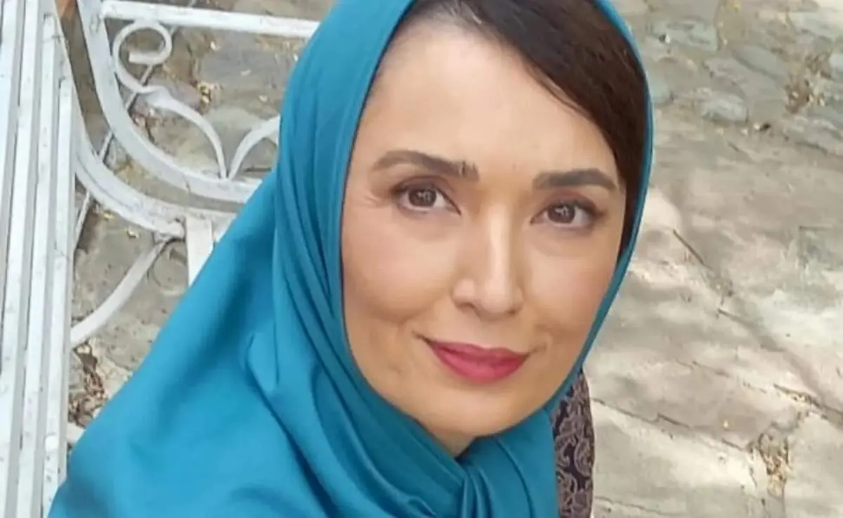 تغییر چهره خانم بازیگر معروف «لیسانسه‌ها»، پس از هفت سال+ عکس