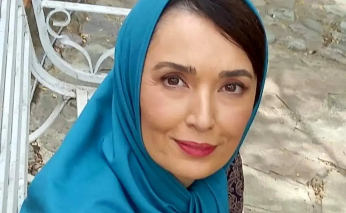 تغییر چهره خانم بازیگر معروف «لیسانسه‌ها»، پس از هفت سال+ عکس