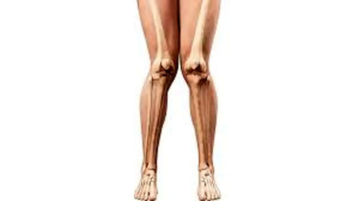  زانوی ضربدری چیست ؟