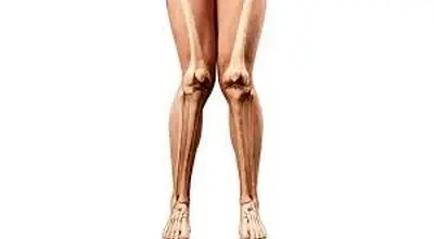  زانوی ضربدری چیست ؟