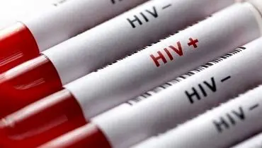 HIV از چه راه‌هایی منتقل نمی‌شود؟