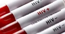 HIV از چه راه‌هایی منتقل نمی‌شود؟