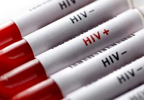 بیشترین شیوع HIV در این بازه سنی