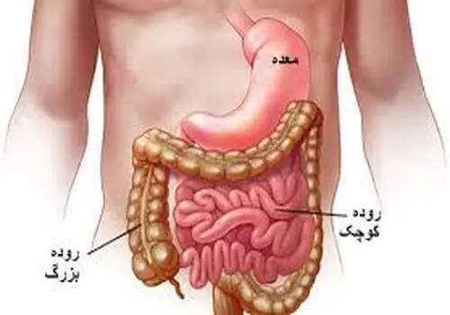 پیشگیری از سرطان روده بزرگ با چند راهکار ساده و ارزان