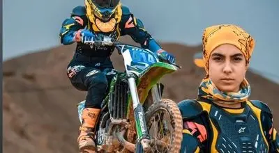 آخرین وضعیت دختر موتورسوار پس از ۳۴ روز کما

