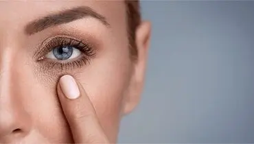 علت سیاهی دور چشم و روش‌های رفع آن
