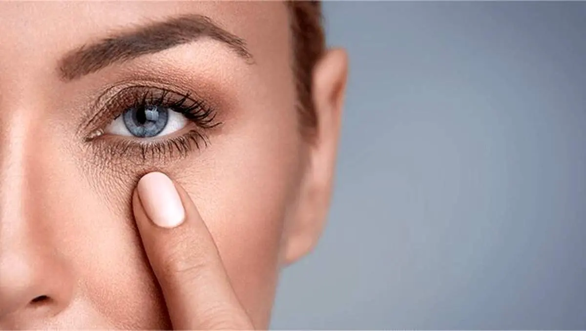 علت سیاهی دور چشم و روشهای رفع آن