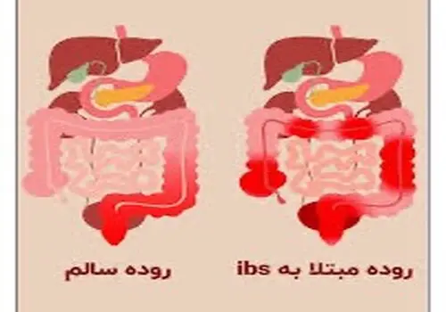 قطعی و اختلال در شبکه تلفن همراه اول

