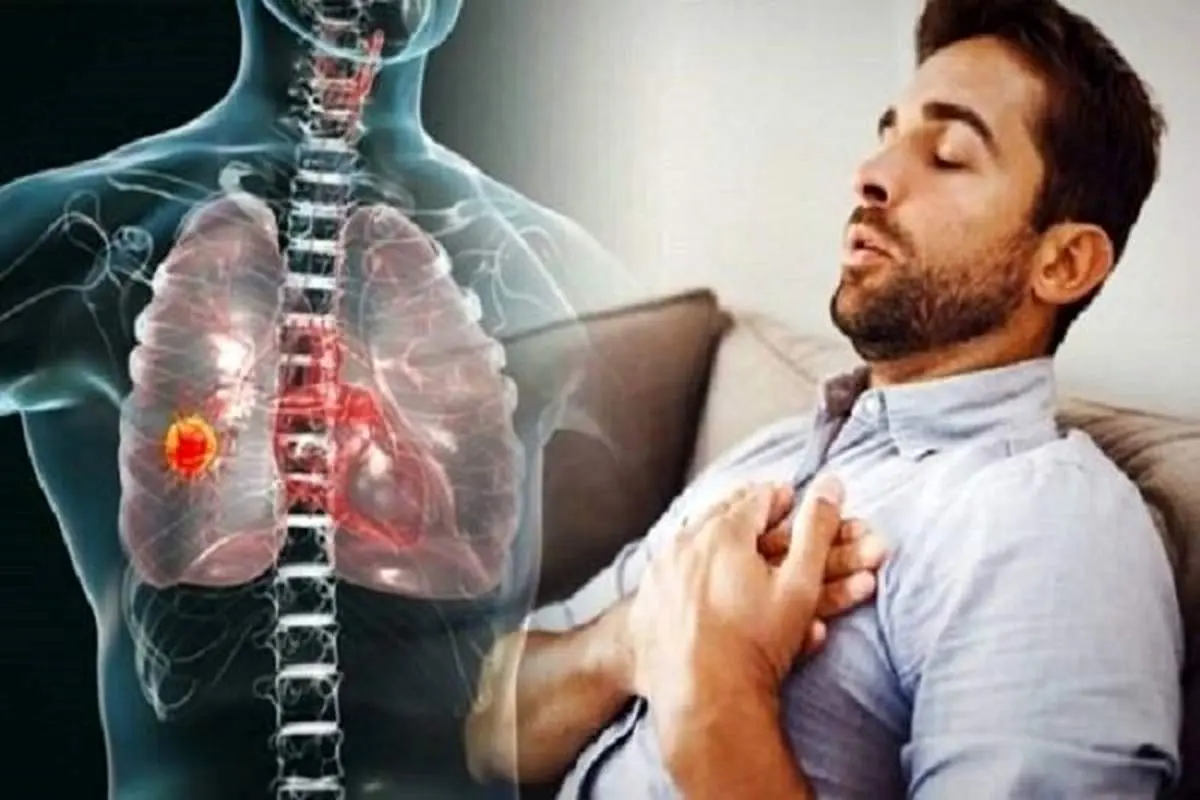 چگونه در شرایط بحرانی حمله آسم را مهار کنیم؟