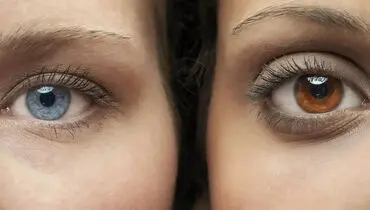 هزینه های لاکچری عمل زیبایی چشم؛ از تغییر رنگ چشم تا کاشت نگین!