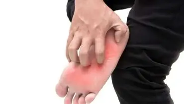 خارش کف پا را جدی بگیریم؟ از علت‌های ساده تا نشانه‌های خطرناک