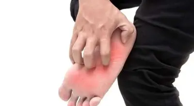 خارش کف پا را جدی بگیریم؟ از علت‌های ساده تا نشانه‌های خطرناک