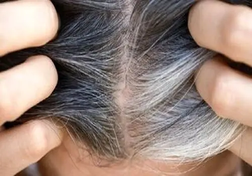 اگر موهایتان زود سفید می‌شود، این نکات را بدانید