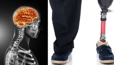 ماجرای مردی که از پزشکان خواست دو انگشتش را قطع کنند