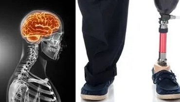 ماجرای مردی که از پزشکان خواست دو انگشتش را قطع کنند