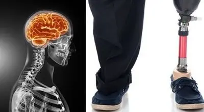 ماجرای مردی که از پزشکان خواست دو انگشتش را قطع کنند