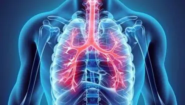 قاتل خاموش سلامت ریه 