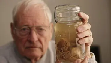 همه چیز درباره مغز آلبرت اینشتین+ عکس