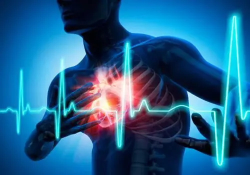 بیشتر حملات قلبی قابل پیشگیری هستند