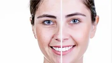 برای مقابله با پیری پوست، این ۴ خوراکی را حتما بخورید!