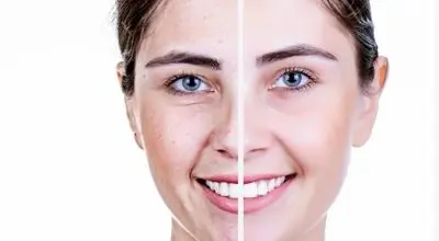 برای مقابله با پیری پوست، این ۴ خوراکی را حتما بخورید!