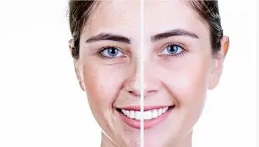 برای مقابله با پیری پوست، این ۴ خوراکی را حتما بخورید!